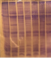 Jundishapur J Microbiol